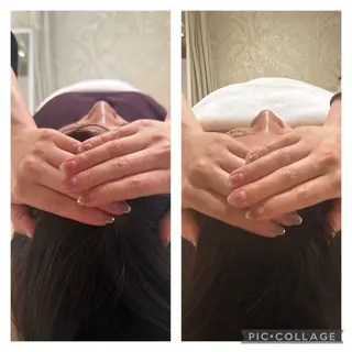 小顔矯正 MEGUMIのエステ・リラクイメージ