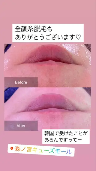 産毛専門店 Bittoのエステ・リラクイメージ