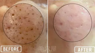 毛穴/毛穴洗浄専門 エミルカ船橋のエステ・リラクイメージ