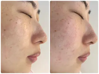 パーソナル肌質改善 🦋APRI🅿️有のエステ・リラクイメージ