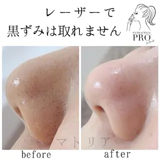 小顔と美肌 まごころエステMatoria所属・小顔 美肌専門 Matoriaのエステ・リラクイメージ