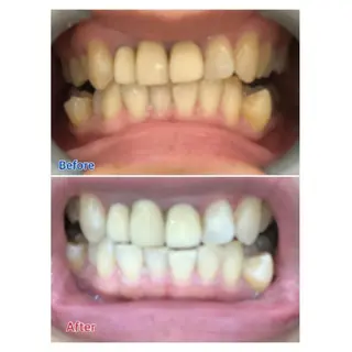 M渋谷店所属・Ｍ渋谷 ホワイトニングのエステ・リラクイメージ