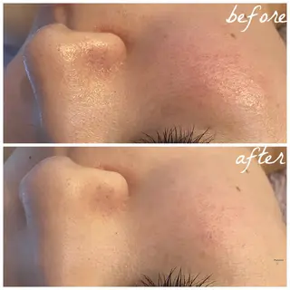 メンズ メナード岐阜市茜部 杉浦のエステ・リラクイメージ