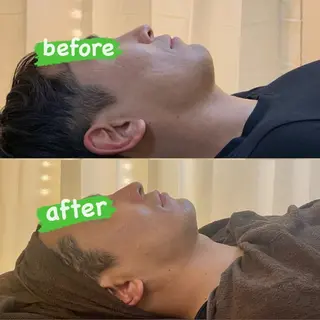 BELCIA福岡店　récolte de BELCIA（レコルトデベルシア）所属・BELCIA福岡店 レコルトデベルシアのエステ・リラクイメージ