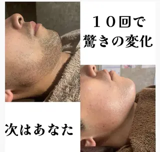 男女同額脱毛エステ salonLEPIAのエステ・リラクイメージ