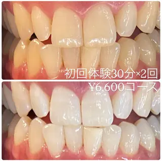 PLATINUM Beauty 横浜店所属・ホワイトニングルーム 横浜店のその他イメージ