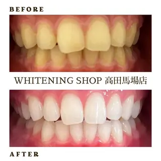 メンズ ホワイトニング ショップ高田馬場店のその他イメージ