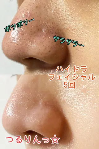 vary  clue MISAのエステ・リラクイメージ