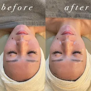 うなじ脱毛/美肌脱毛 LABELのエステ・リラクイメージ