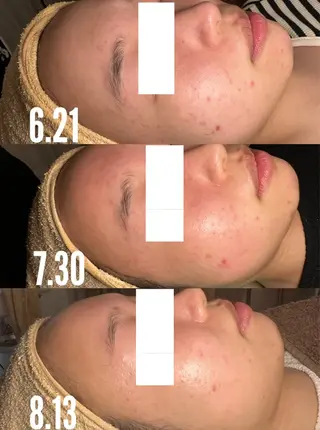 a room salonのエステ・リラクイメージ