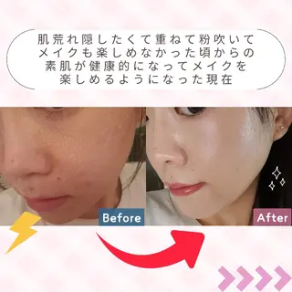 痩身ハーブピーリング 筋膜リリース☆B&Hのエステ・リラクイメージ