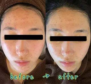 口コミ★5獲得 Claire鈴木のエステ・リラクイメージ