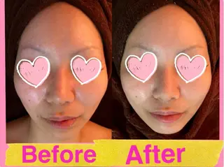 痩身リンパダイエット 隠れ家サロンチャームのエステ・リラクイメージ