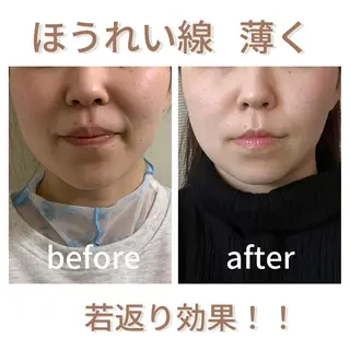 小顔サロン AMYONのエステ・リラクイメージ