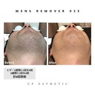 ウプエステティック所属・韓国肌管理 ウプエステティックのエステ・リラクイメージ