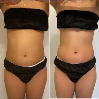 ララ/ハーブ メゾンリュバンのエステ・リラクイメージ