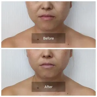 nail RiRi アトレナチュラのエステ・リラクイメージ