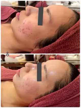 ハーブピーリングMB eautySalonのエステ・リラクイメージ