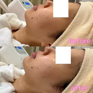 肌質改善美容サロン ému 用賀のエステ・リラクイメージ