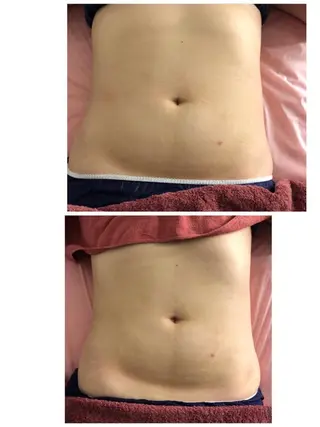 【ニキビ/肌管理】 salon varyのエステ・リラクイメージ