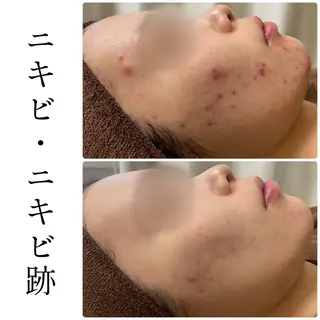 ハーブピーリング専門 BIOEL横浜のエステ・リラクイメージ