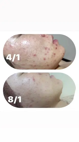 【足圧】鬼👹リンパ 身体整うサロンのエステ・リラクイメージ