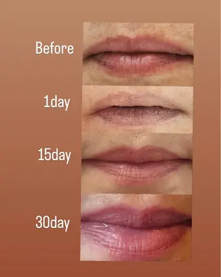 小顔/たるみ/黒ずみ除去専門サロン/SONA 大和西大寺店所属・【小顔専門看護師 サロンSONA】のエステ・リラクイメージ