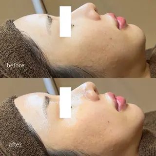 【韓国人肌製作所】 水光肌ならアーネストのエステ・リラクイメージ