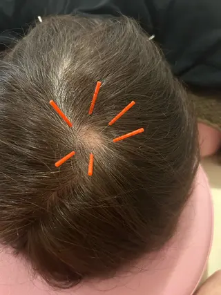 かすがい鍼灸院Re.heart所属・かすがい鍼灸院 Re.heartのエステ・リラクイメージ