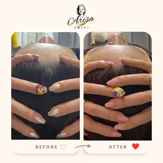 💎小顔ｻﾛﾝ アリリン銀座💎のエステ・リラクイメージ