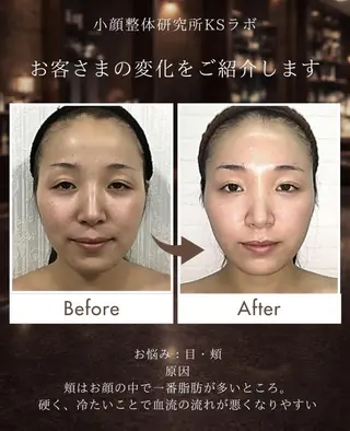 小顔整体研究所 KSラボ川崎店内田のエステ・リラクイメージ
