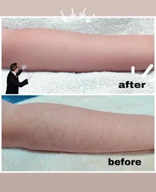 美肌脱毛専門店 ディオーネ四日市店のエステ・リラクイメージ