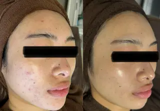 NOBLE 新宿本店のエステ・リラクイメージ