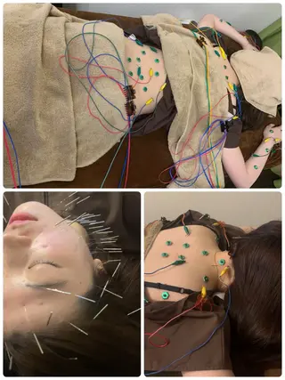 表参道鍼灸院K 美容鍼🔮ララピールのエステ・リラクイメージ