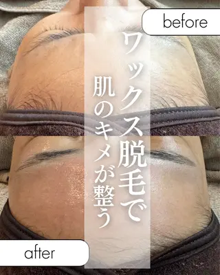 una salon / ネイル&顔脱毛のエステ・リラクイメージ