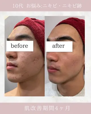 メンズ ARuru所属・ARuru 本店のエステ・リラクイメージ