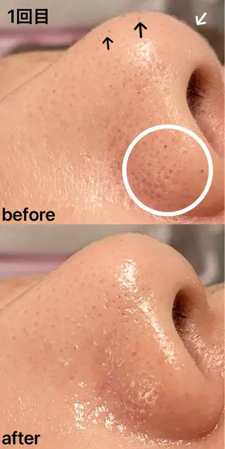 眉毛×小顔矯正サロン パピヨンsakiのエステ・リラクイメージ