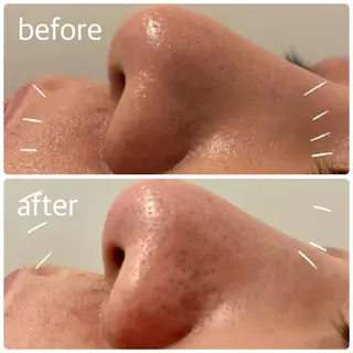 Fulala 永田のエステ・リラクイメージ