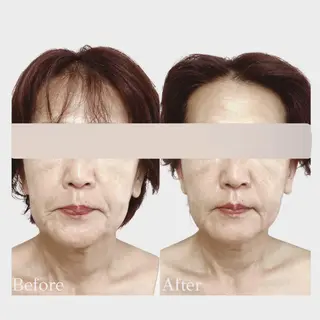 看護師 AYUIのエステ・リラクイメージ