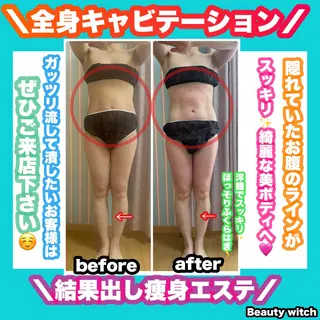 痩身/脱毛/ネイル HARUKAのエステ・リラクイメージ