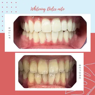 セルフホワイトニング Dolce水戸店のその他イメージ