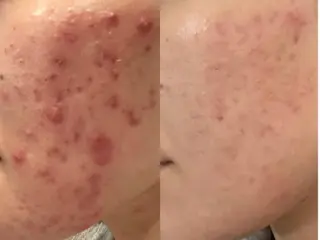 Facial Salon LUIRE所属・LUIRE　 ルイールのエステ・リラクイメージ