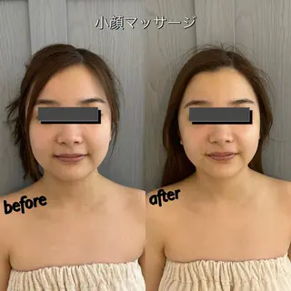 うなじ脱毛/美肌脱毛 LABELのエステ・リラクイメージ