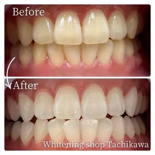 セルフ　ホワイト ニングショップ立川のその他イメージ