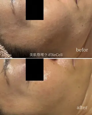 FLORALNOTE所属・ReCell 肌管理のエステ・リラクイメージ