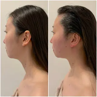 Lani Moon所属・⟡ 京都 小顔  ⊹ Lani Moonのエステ・リラクイメージ