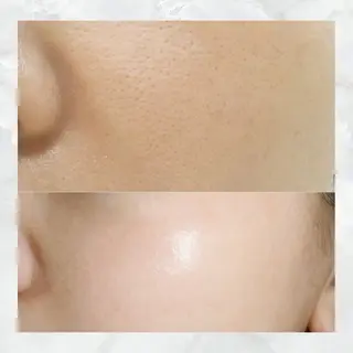 ネイル aliaハイフ&水光ジェットサロン所属・aliaハーブ水光店 エステティシャン募集のエステ・リラクイメージ