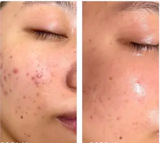 【堺市/泉ヶ丘駅】フェイシャルエステサロンSalon de jewel'm所属・Salon de jewel'm なおのエステ・リラクイメージ