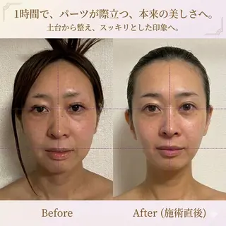 Linomalie エステ/たるみ/脱毛のエステ・リラクイメージ