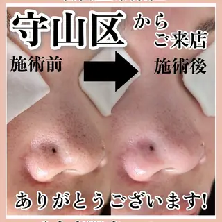  毛穴洗浄・まつ毛 の専門店 ソラーレのエステ・リラクイメージ